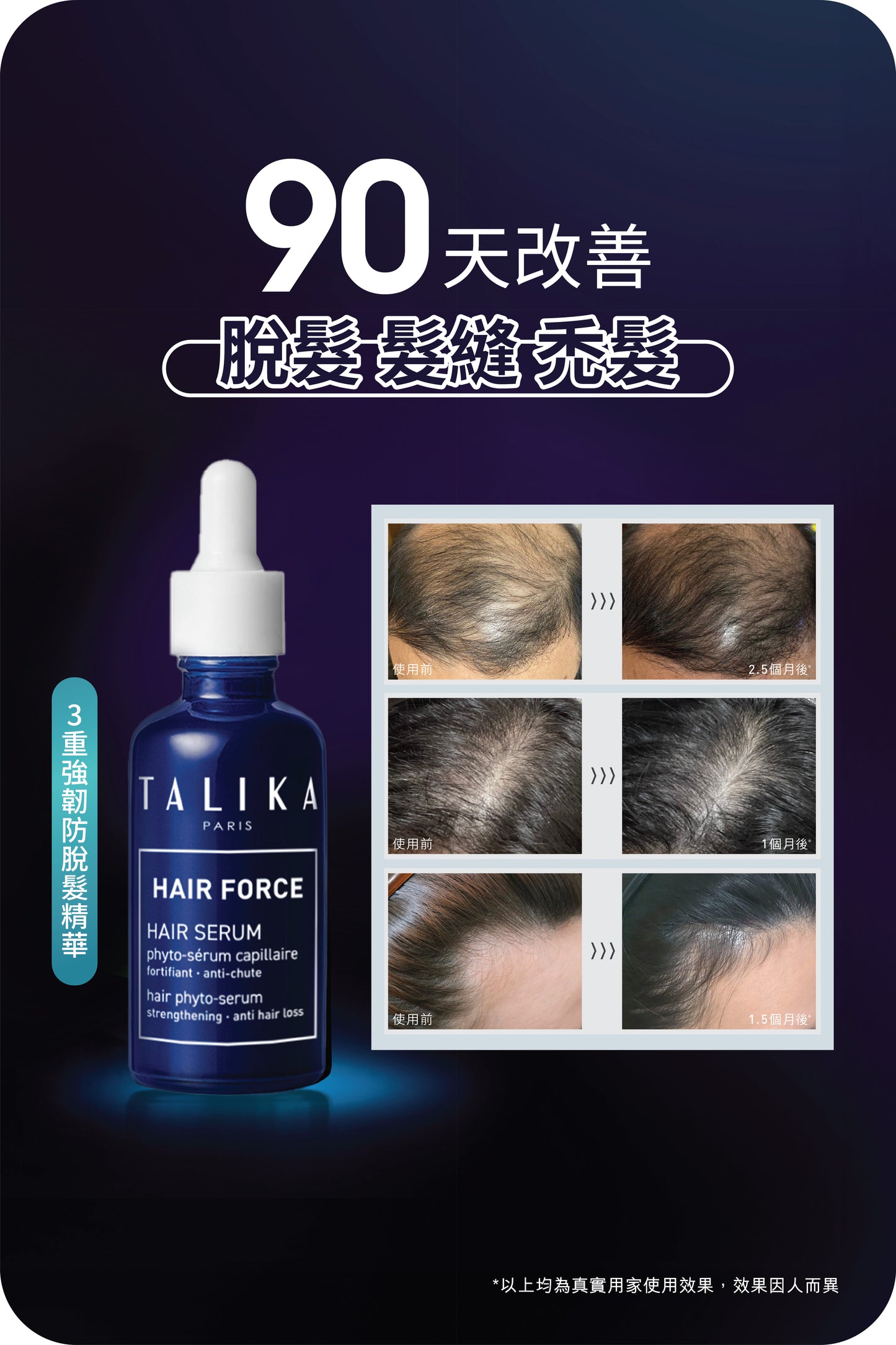 3重強韌防脫髮精華 50ml